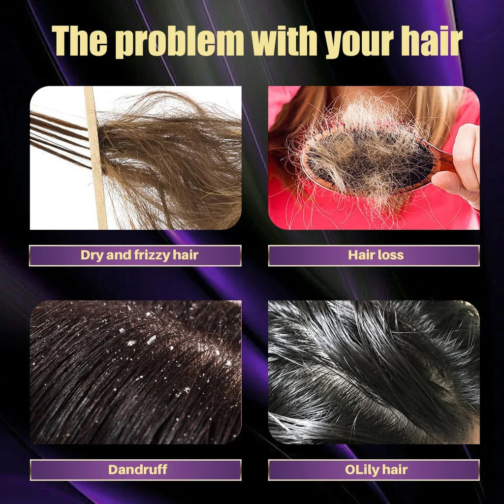 Rosemary Onion Strengthening Shampoo for Hair Growth Repair Damaged Anti Loss Hair Care Shampoo Professional for Men and Women