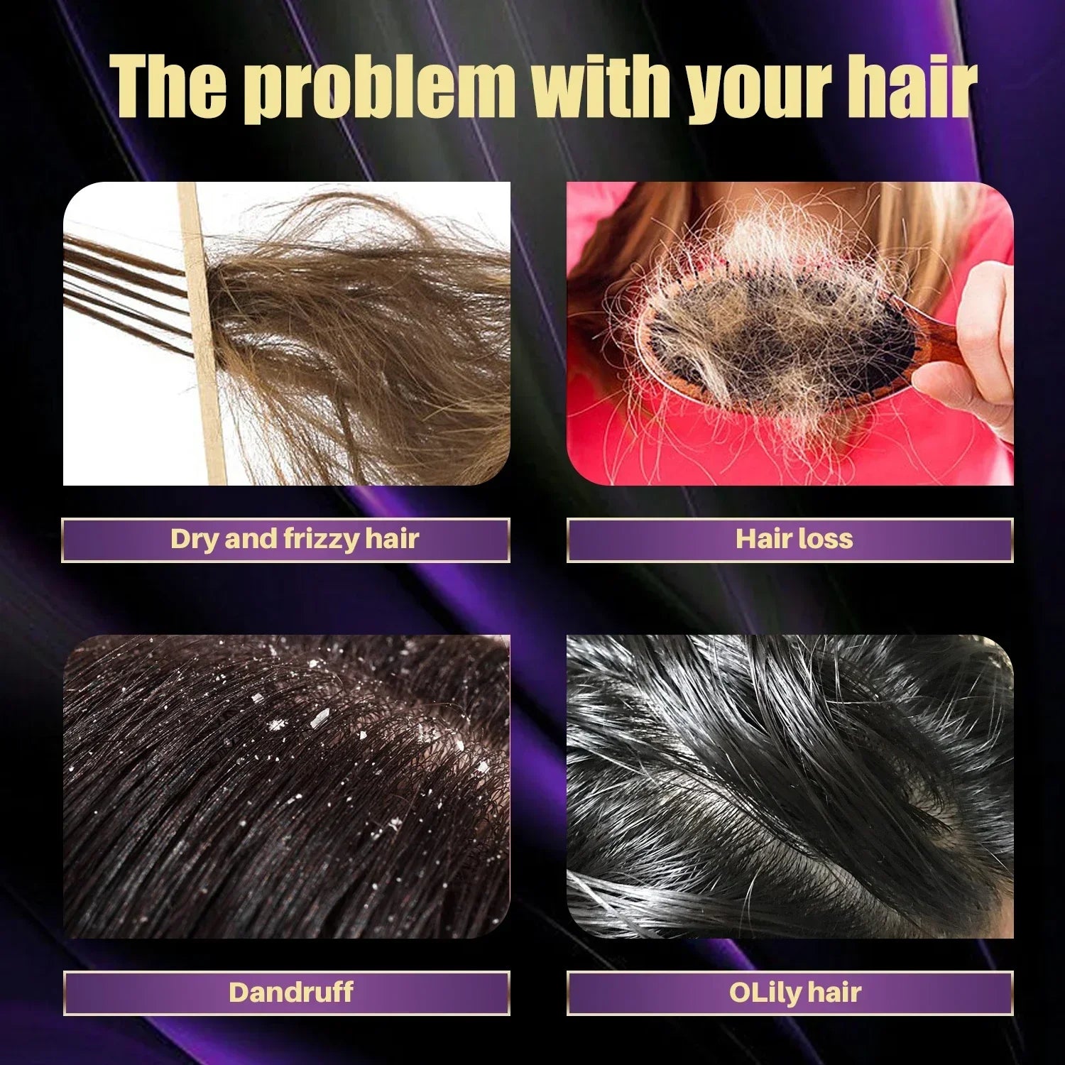 Rosemary Onion Strengthening Shampoo for Hair Growth Repair Damaged Anti Loss Hair Care Shampoo Professional for Men and Women