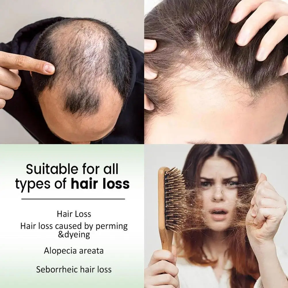 1/2pcs Rosemary Hair Shampoo Volumizing and Thickening Strengthening and Oil Control Nourishes and Repairs Hair Oil Adds Volume