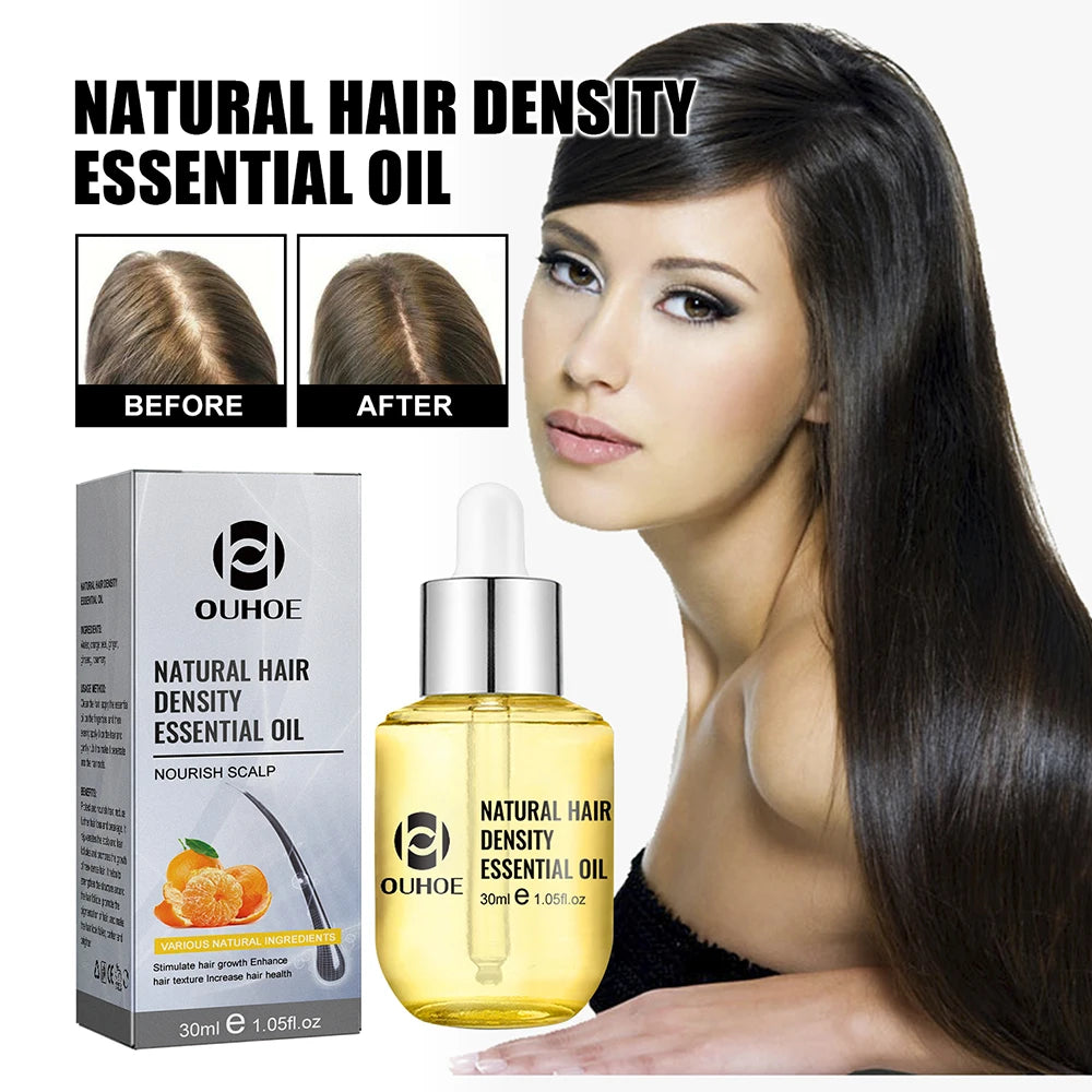 Natural Hair Growth Essential Oil Ginger Essence Hair Regrowth Thicken Hair Treatment Anti Hair Loss Gift Set For Men Women