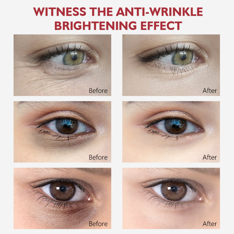 Nicotinamide Eyes Cream Dark Circles Remove Eye Bags Under Eye Hyaluronic Acid Moisturizing Serum Against Puffiness Eye Care Gel