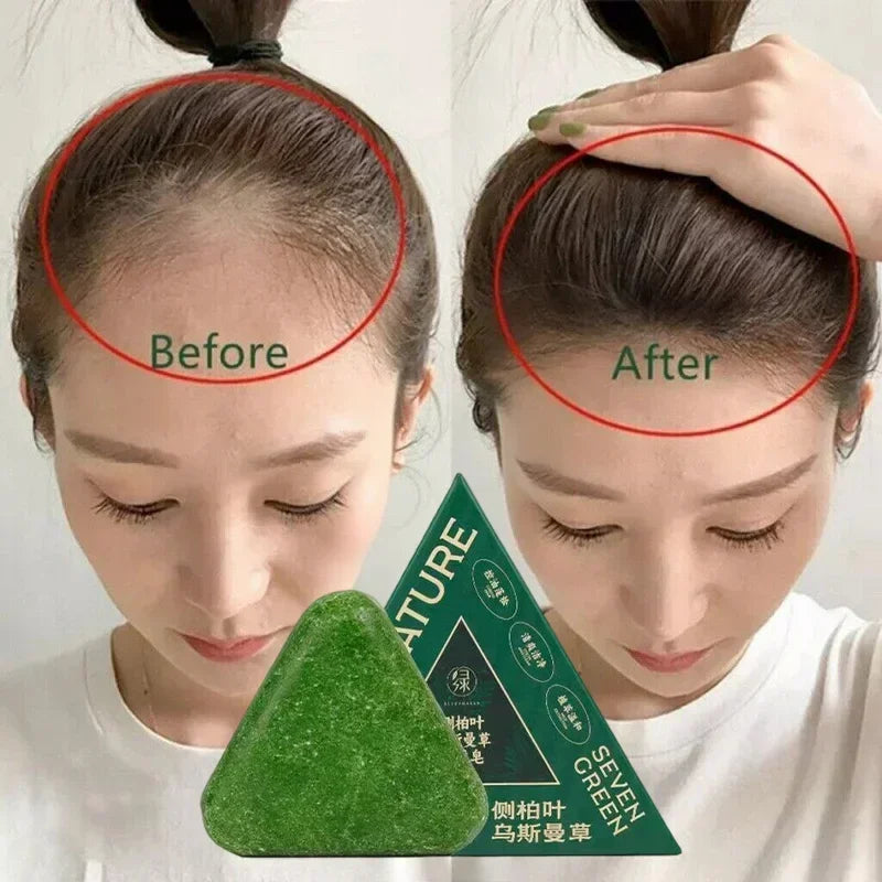 Arborvitae Leaf Shampoo Soap Strongly Fight Dandruff Strengthen Hair Root Effective Oil Control Prevent Hair Loss Solid Shampoo