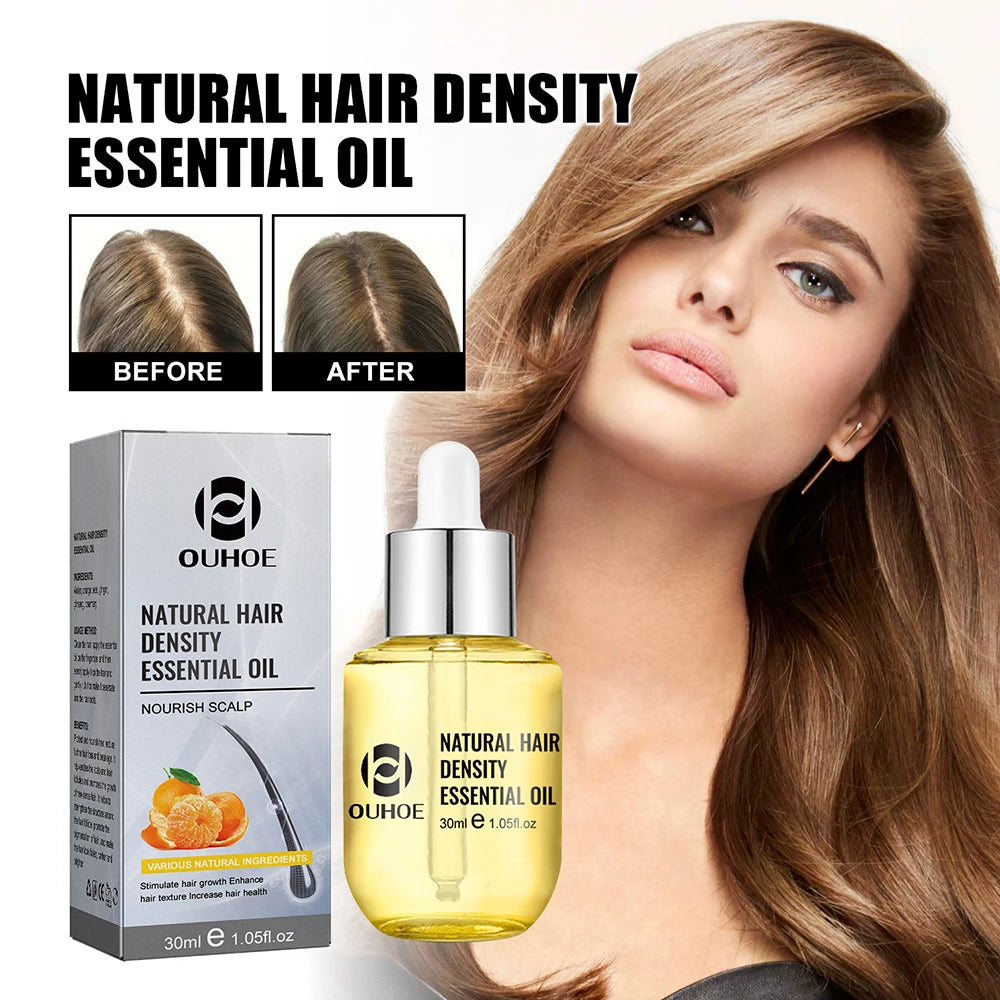 Natural Hair Growth Essential Oil Ginger Essence Hair Regrowth Thicken Hair Treatment Anti Hair Loss Gift Set For Men Women