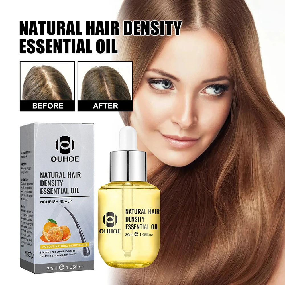 Natural Hair Growth Essential Oil Ginger Essence Hair Regrowth Thicken Hair Treatment Anti Hair Loss Gift Set For Men Women