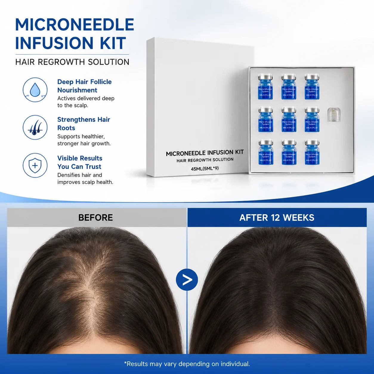 Microneedle Hair Regrowth Kit Solution Scalp Nourishing Serum For Hair Health Maintenance Needle Head Use Scalp Care Kit
