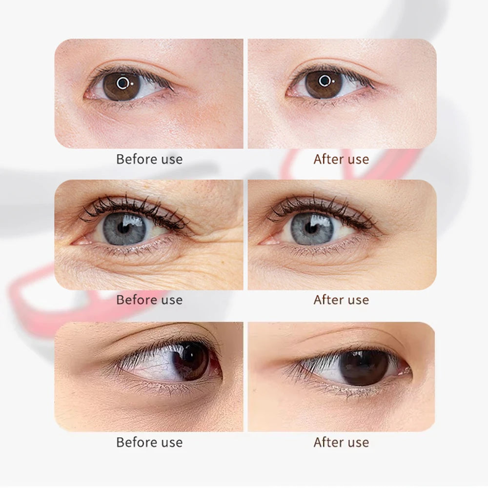 Eye Massager 3 Gear Red light Remove Eye Bags Dark Circles Puffiness Hot Compress Eye Relieve Eye Fatigue Wireless Use