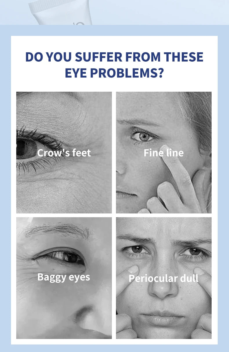 Remove Eye Bag Cream Anti Wrinkle Anti Dark Circle Eye Cream Repair Skin Damage Moisturizing Eye Bags Eyes Skin Care