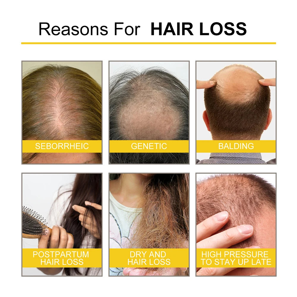 Natural Hair Growth Essential Oil Ginger Essence Hair Regrowth Thicken Hair Treatment Anti Hair Loss Gift Set For Men Women