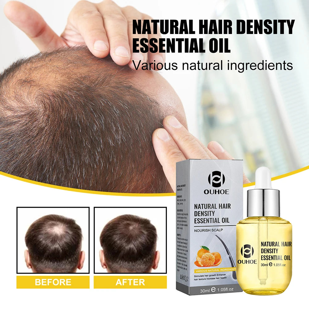 Natural Hair Growth Essential Oil Ginger Essence Hair Regrowth Thicken Hair Treatment Anti Hair Loss Gift Set For Men Women