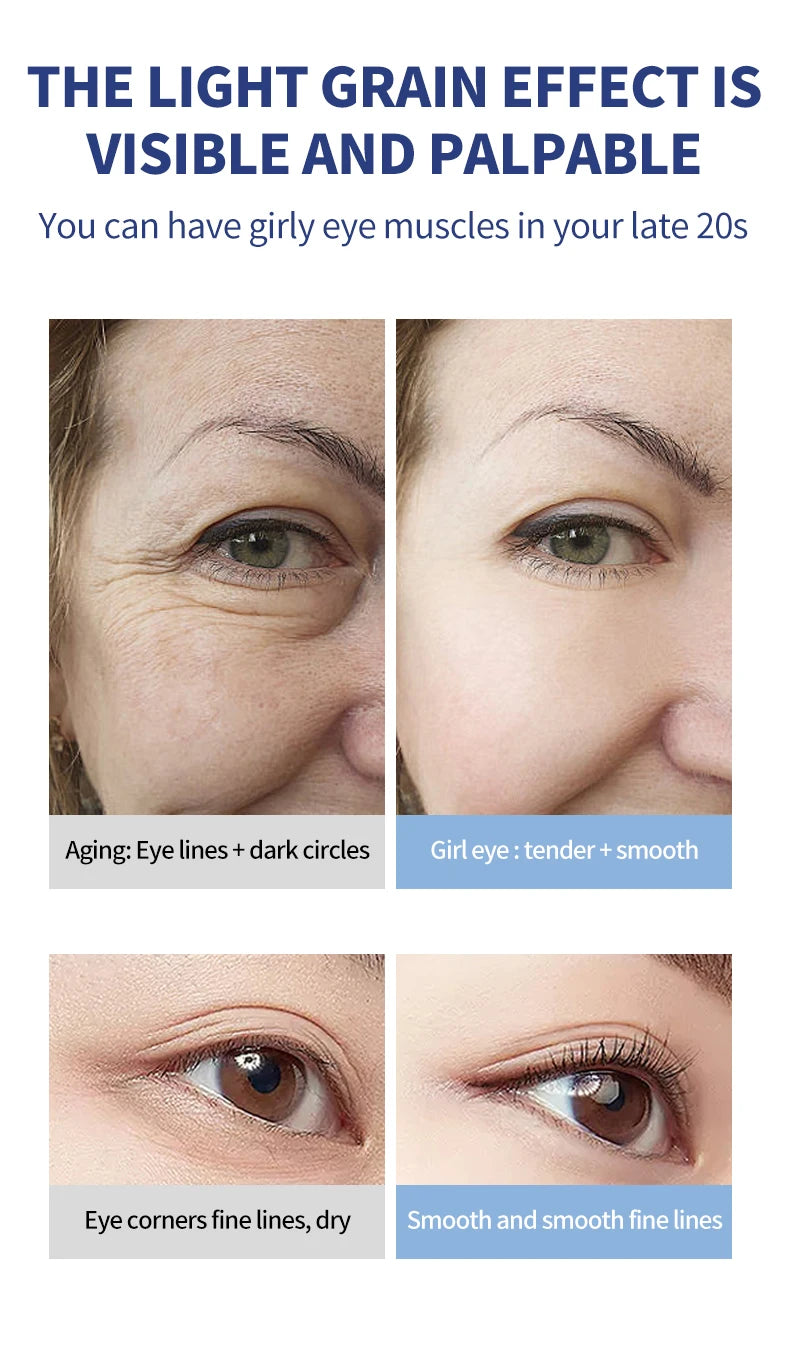 Remove Eye Bag Cream Anti Wrinkle Anti Dark Circle Eye Cream Repair Skin Damage Moisturizing Eye Bags Eyes Skin Care