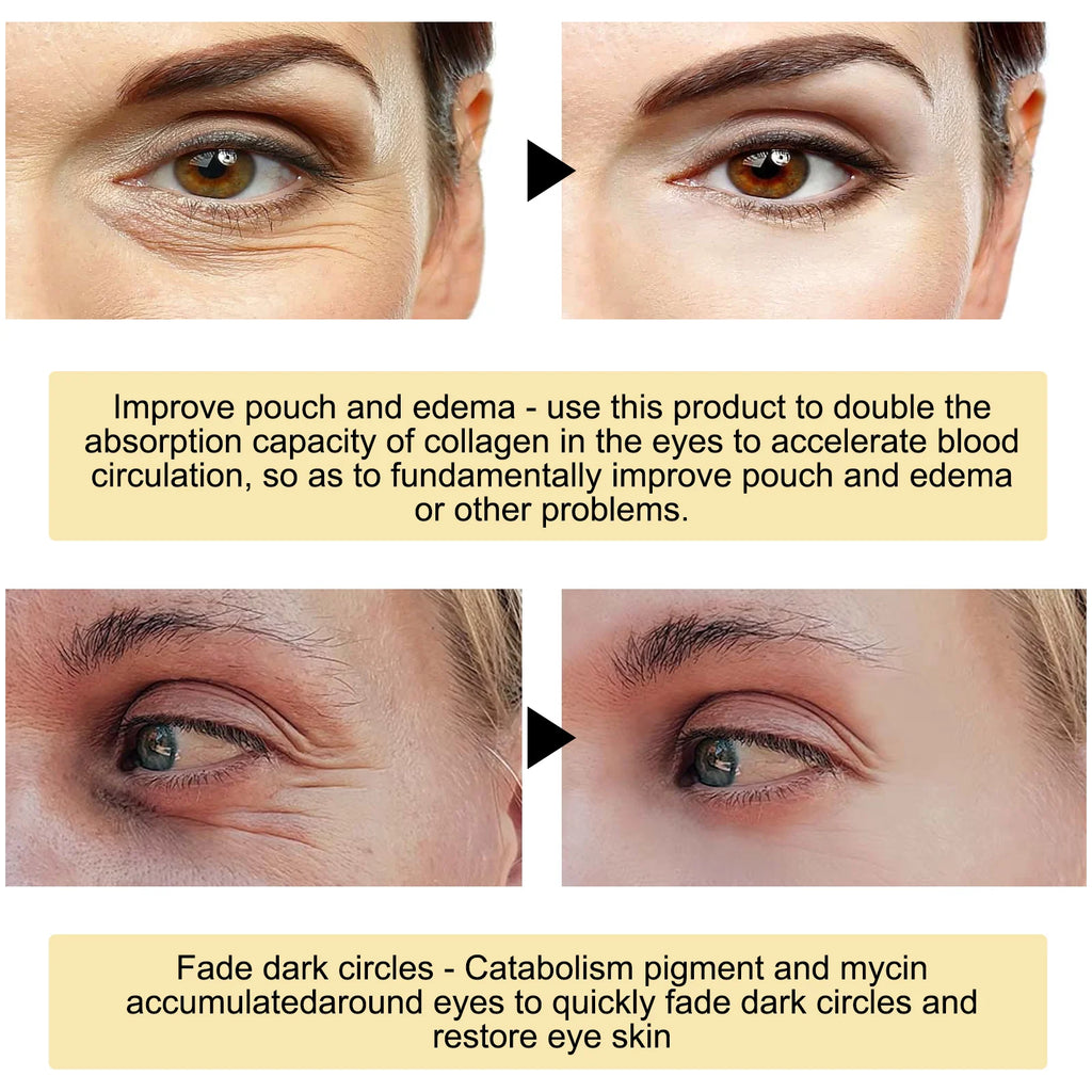24K Gold Eye Mask Removal Eyes Bags Anti Dark Circles Eliminating Puffiness Moisturizing Firming Eye Skin Care Patches