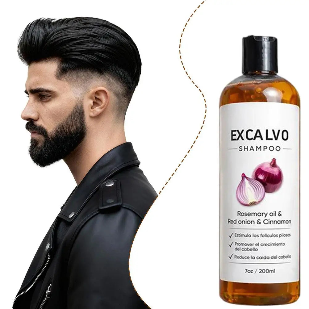 Rosemary Red Onion Hair Shampoo 200ml Strengthens Hair Roots Reduces Hair Loss Deep Cleansing Nourishing Hair Care Products NEW
