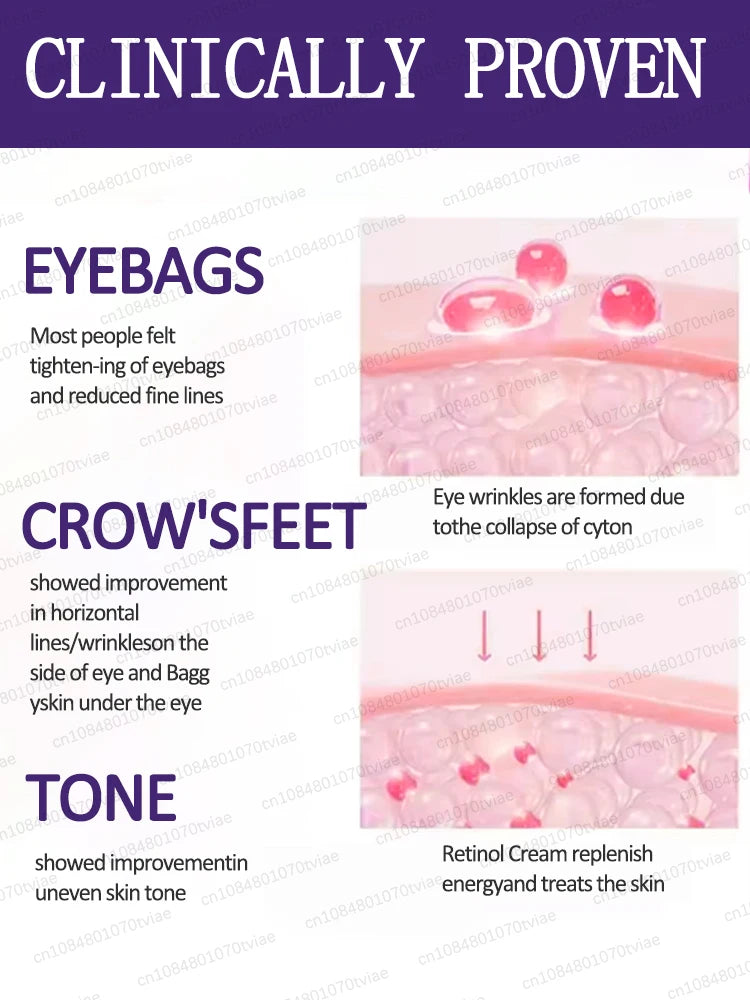 The heavier the eye bags and dark circles, the better the effect