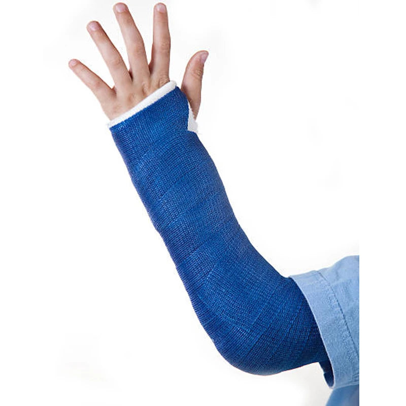 5/7.5/10/15x360cm Fiberglass Polyurethane Orthopedic Fracture Fixation Bandage Medical Orthopedic Casting Tape