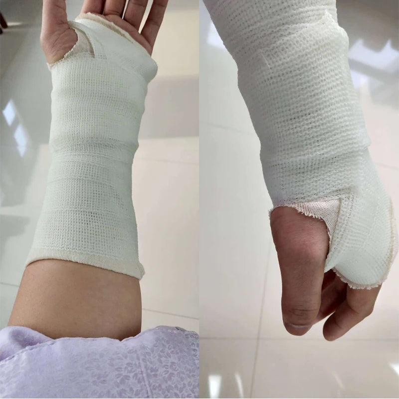 5/7.5/10/15x360cm Fiberglass Polyurethane Orthopedic Fracture Fixation Bandage Medical Orthopedic Casting Tape