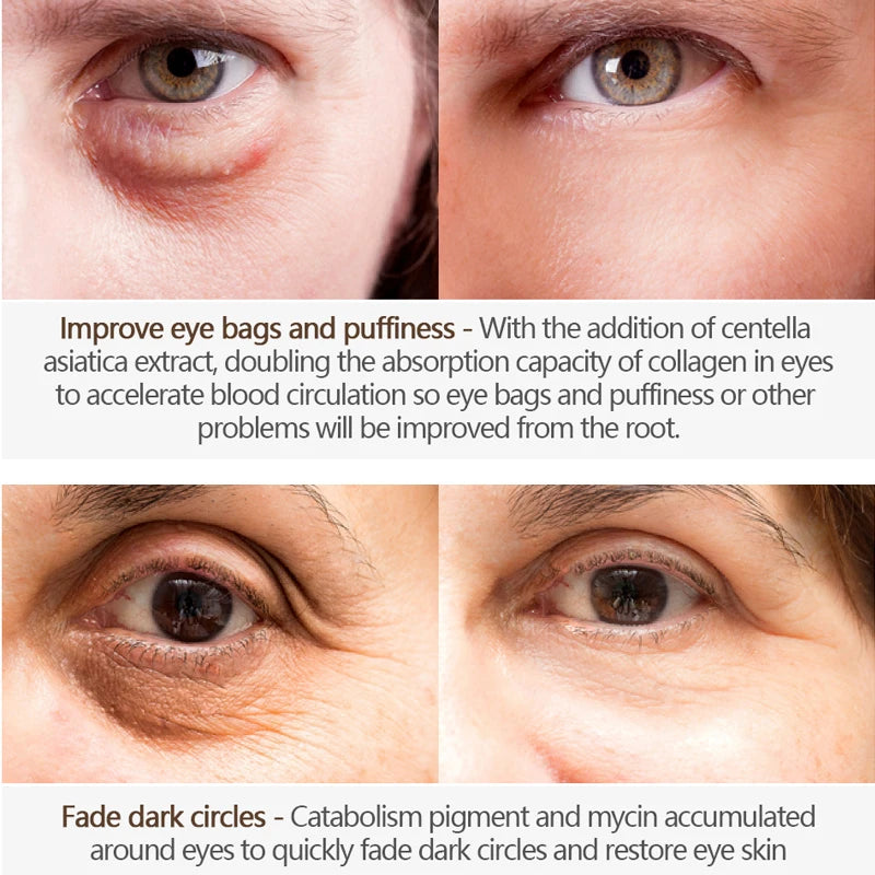 Nicotinamide Eyes Cream Dark Circles Remove Eye Bags Under Eye Hyaluronic Acid Moisturizing Serum Against Puffiness Eye Care Gel