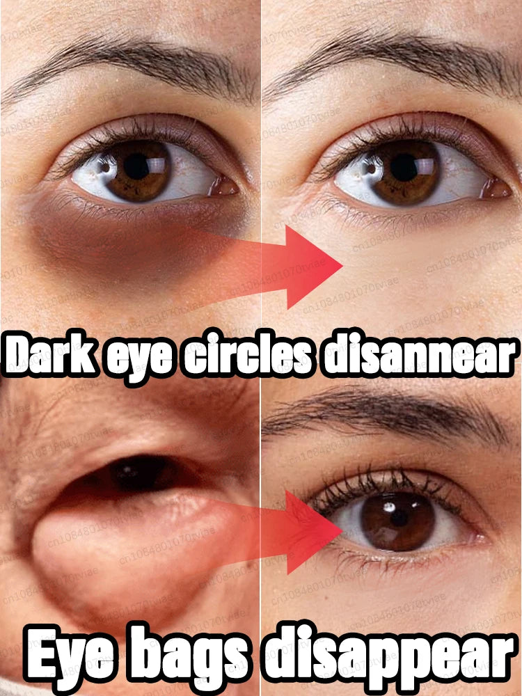 The heavier the eye bags and dark circles, the better the effect