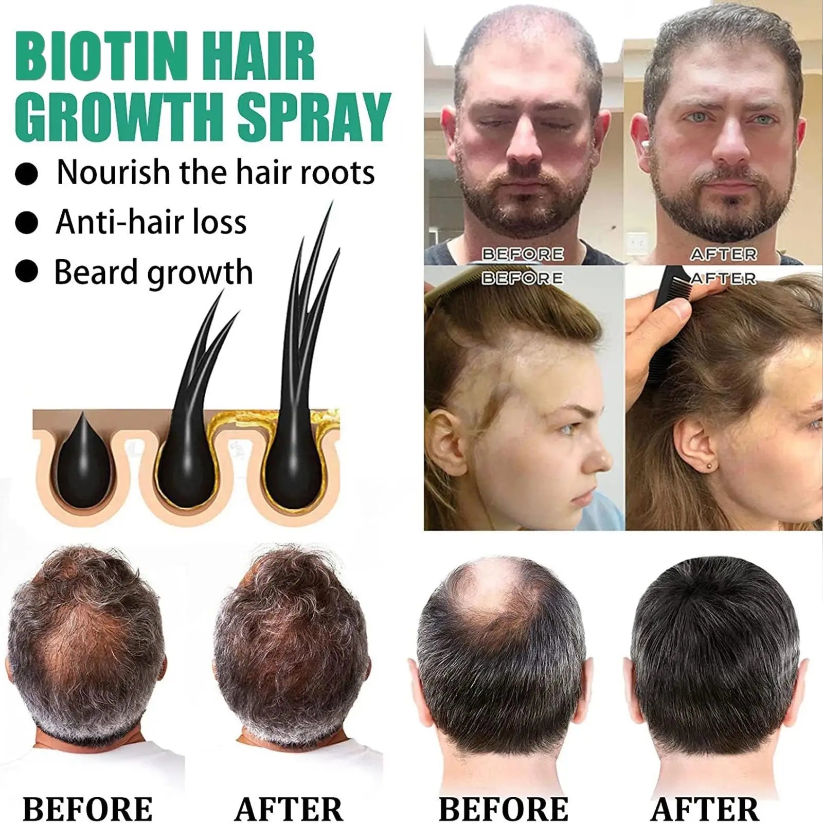 Scalp Repair Hair Thicken Conditioner Hair Thickening Care Products Beard Thickening Care Oil Serum Professional Hair Care