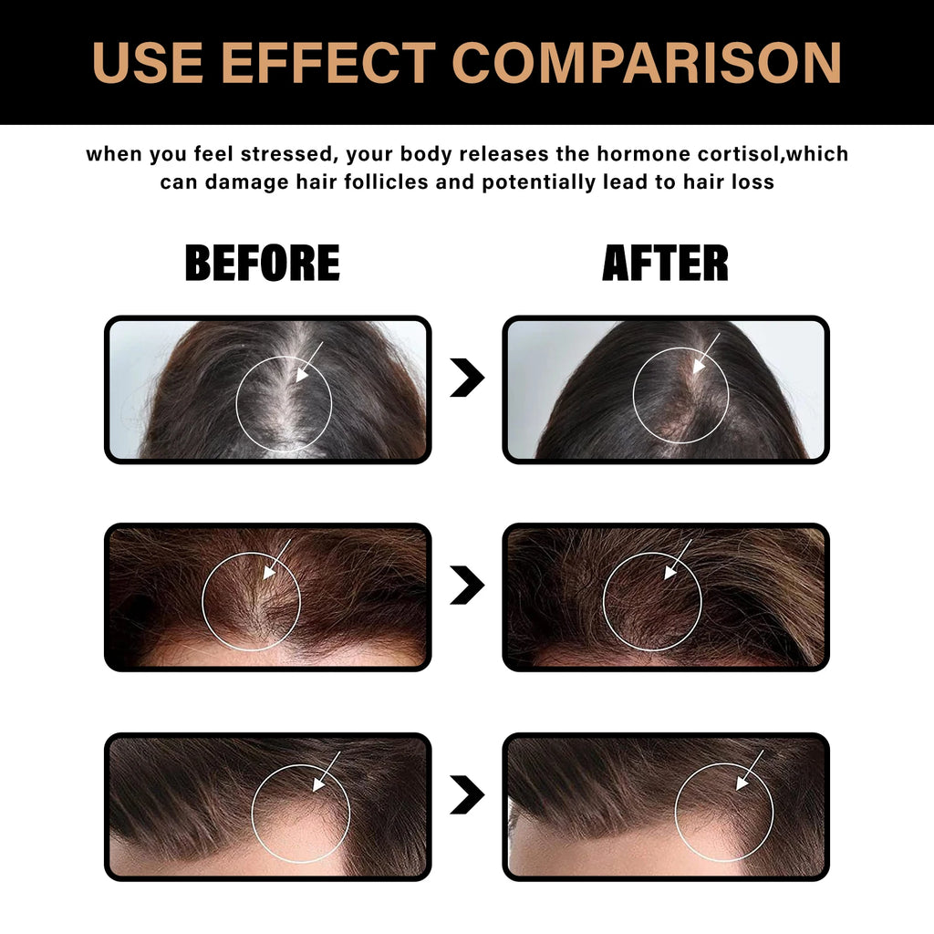 2pcs Anti Baldness Shampoo Thickening Shampoo Root Activator Shampoo Nourish Hair Regrowth for Thinning Hair & Hair Loss Care