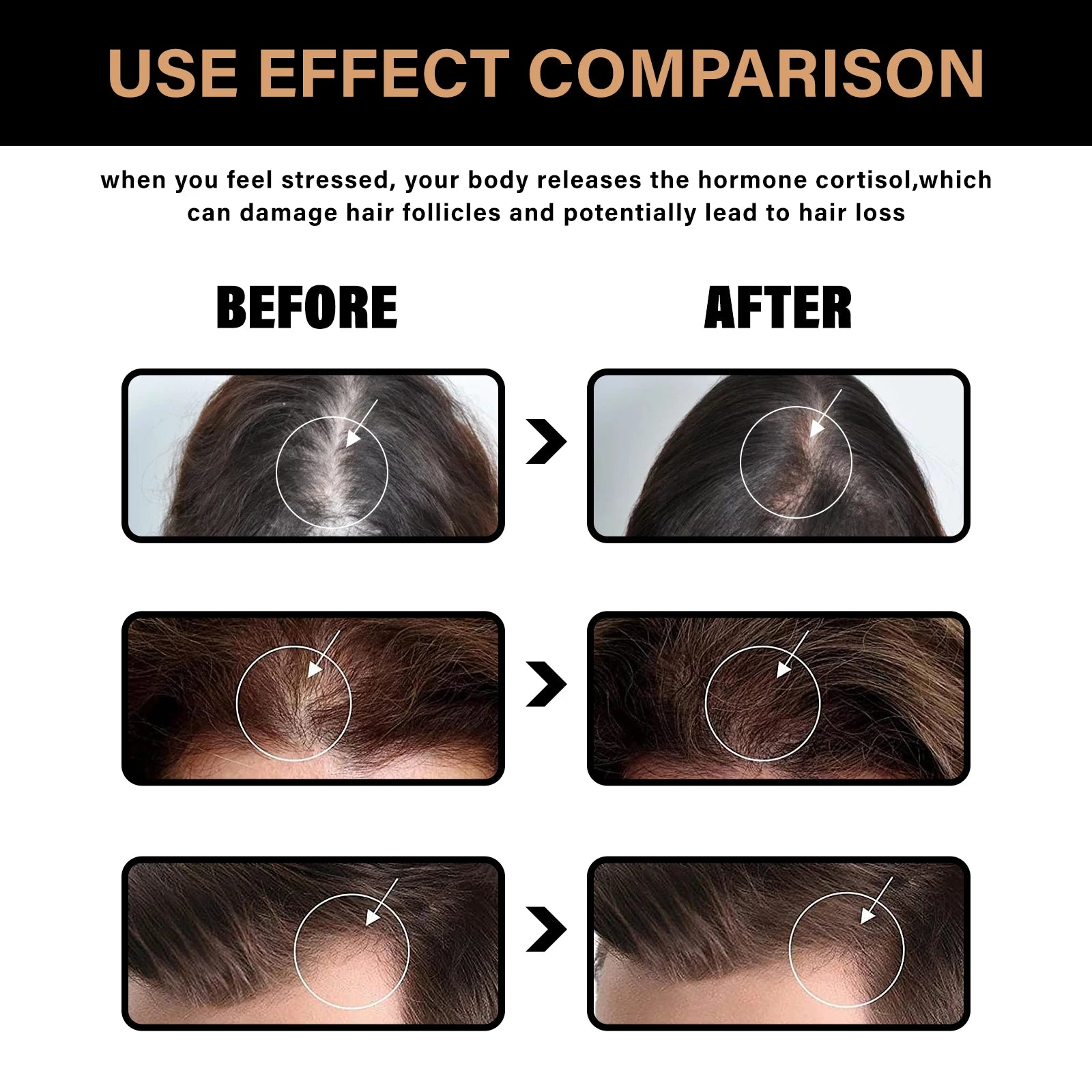 2pcs Anti Baldness Shampoo Thickening Shampoo Root Activator Shampoo Nourish Hair Regrowth for Thinning Hair & Hair Loss Care