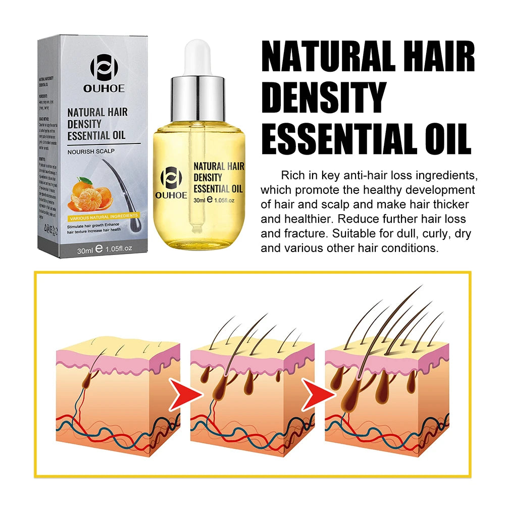 Natural Hair Growth Essential Oil Ginger Essence Hair Regrowth Thicken Hair Treatment Anti Hair Loss Gift Set For Men Women