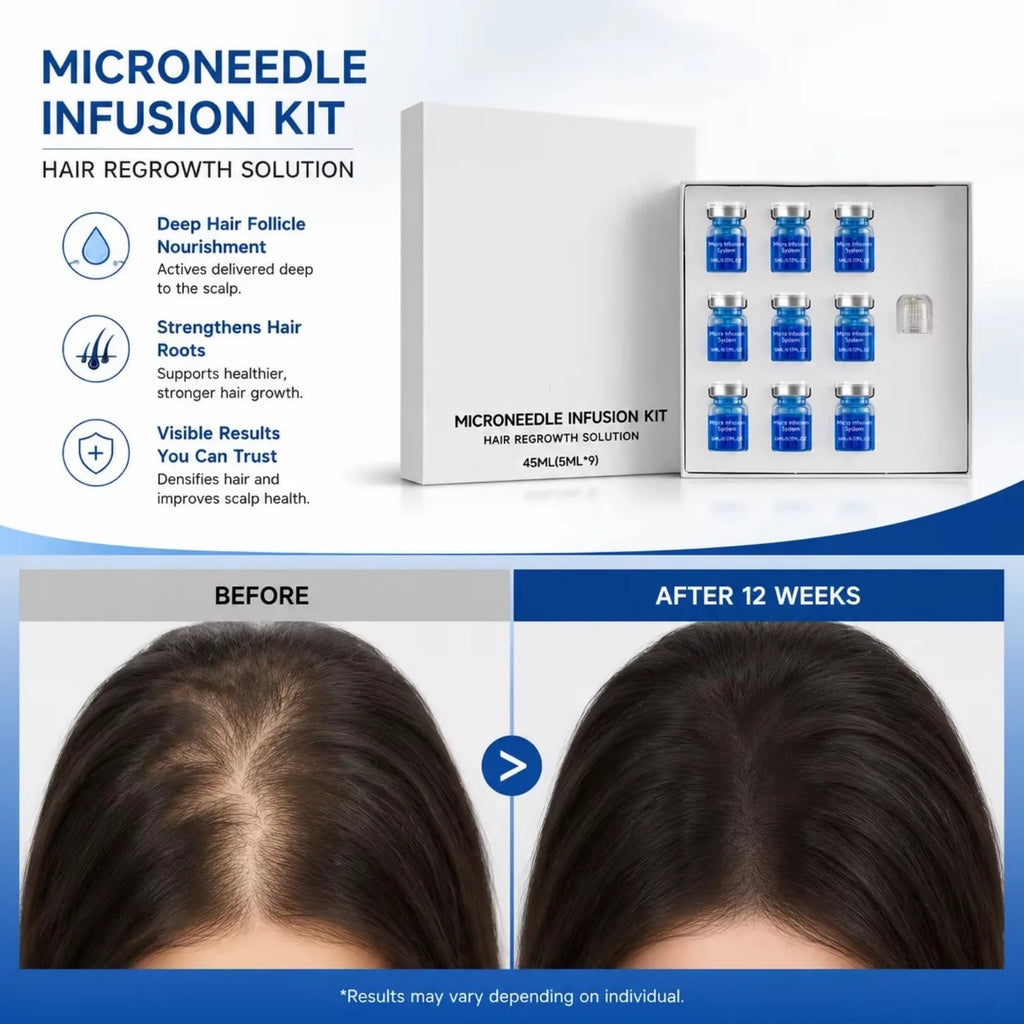 Hair Regrowth Microneedle Infusion Kit Nourishing Scalp Roots Anti-Thinning Hair Care Ampoule Serum Deep Penetration Scalp Serum