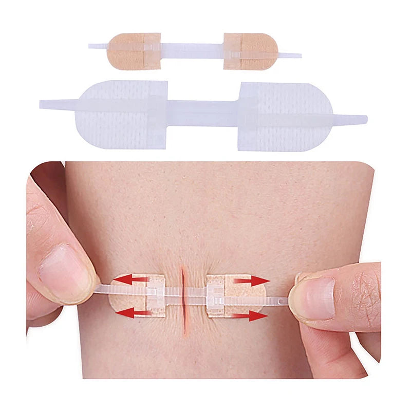3Pcs Zipper Tie Wound Closure Patch Hemostatic Patch Wound Fast Suture Zipper Band-Aid Outdoor Portable Skin Care