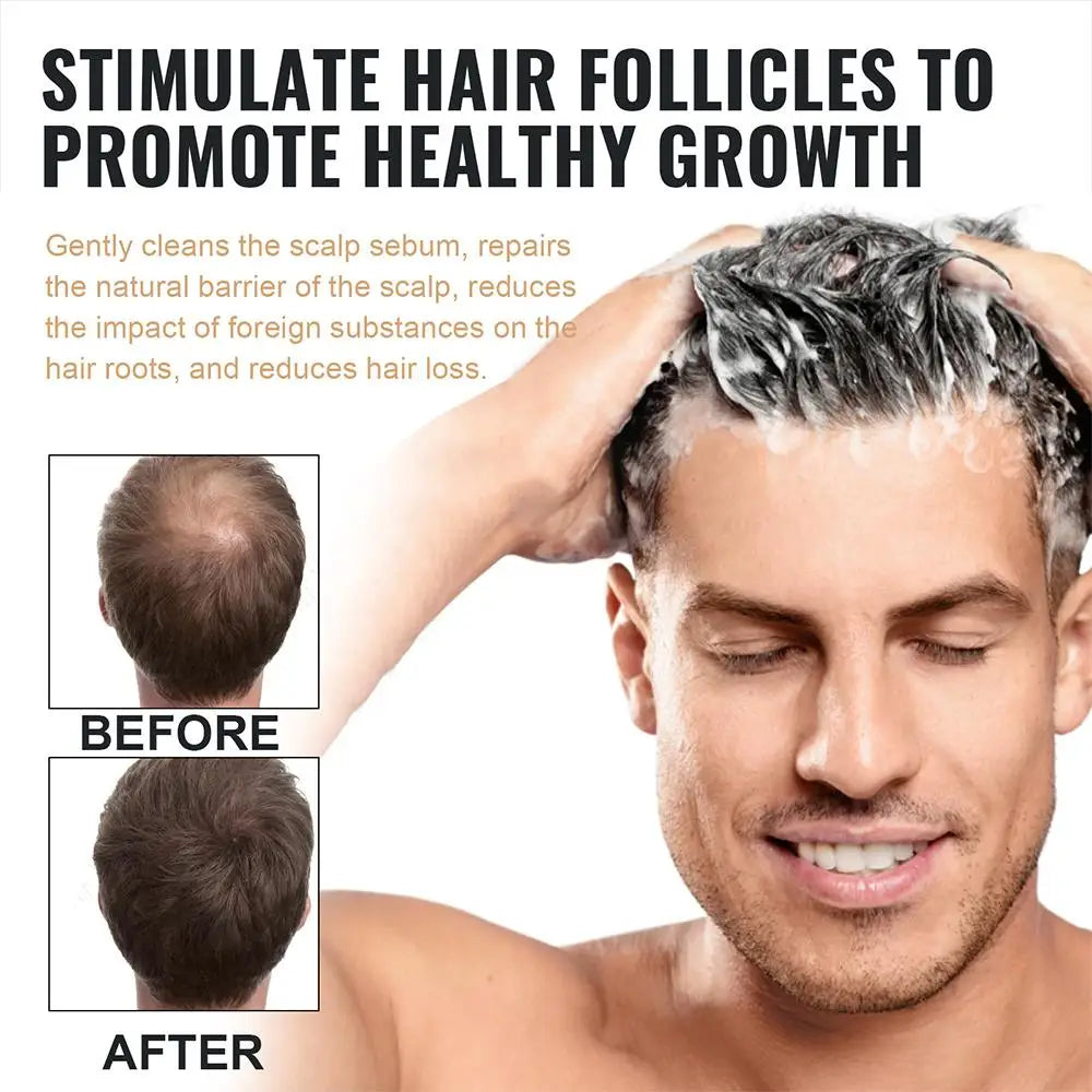 2PCS Anti Baldness Shampoo Thickening Shampoo Root Activator Shampoo Nourish Hair Regrowth Shampoo For Thinning Hair & Hair Loss