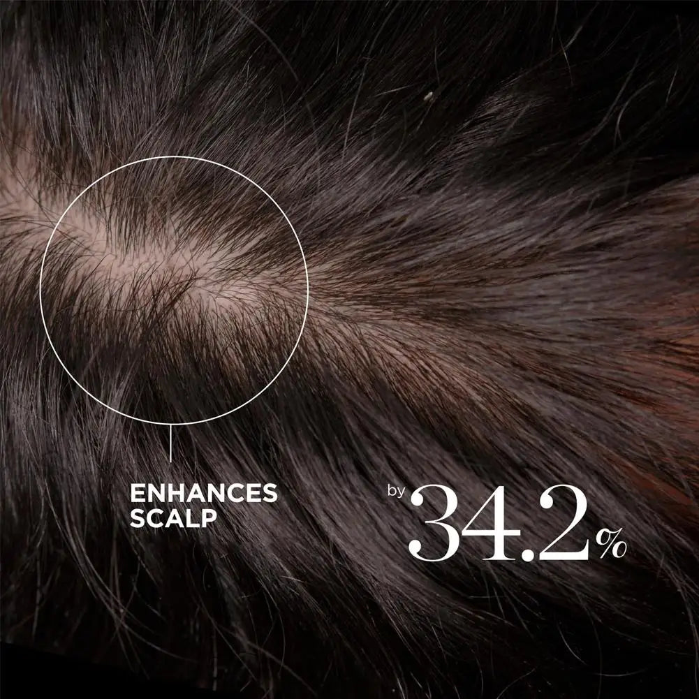 Dr.Groot Anti-hair loss Shampoo Deep Moisturizing Softening Tnourishing hair roots Remove Dandruff Oil Control Gentle Hair Care