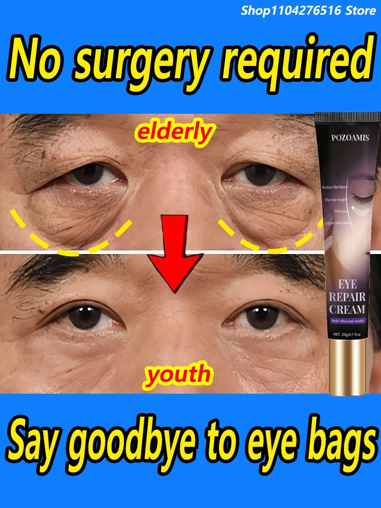 The heavier the eye bags and dark circles, the better the effect
