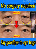 The heavier the eye bags and dark circles, the better the effect