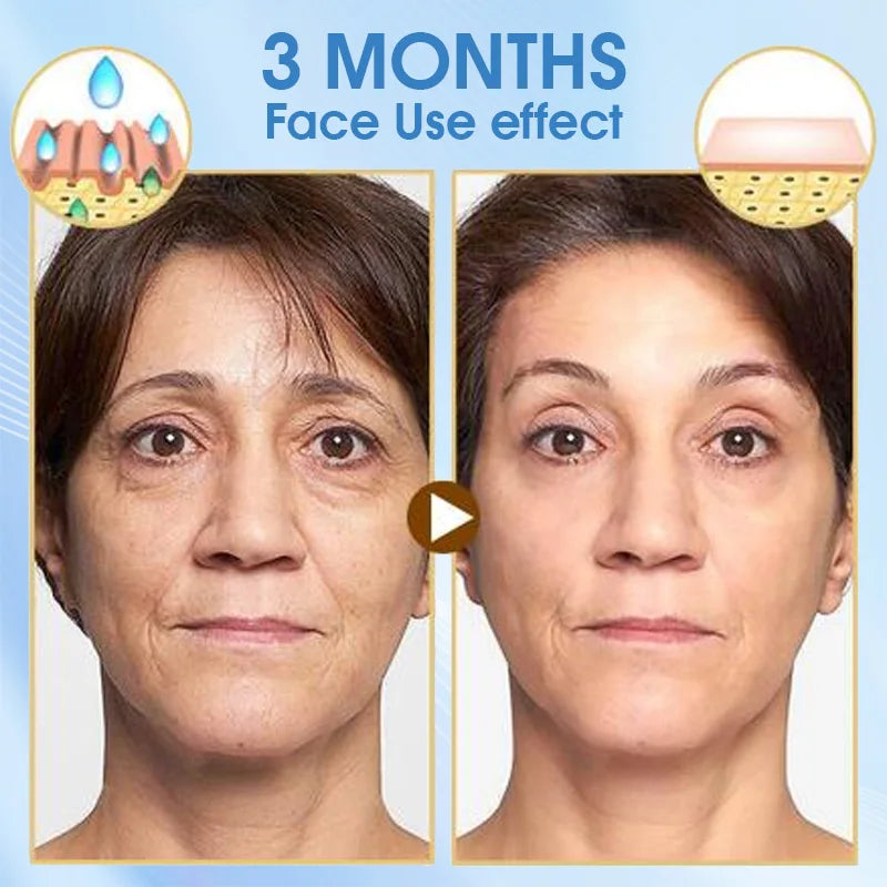 Coenzyme Q10 Anti-aging Day Cream Anti Wrinkles Night Cream Combination Set Vitamin E Moisturizing Cream Reduce Facial Fine Line