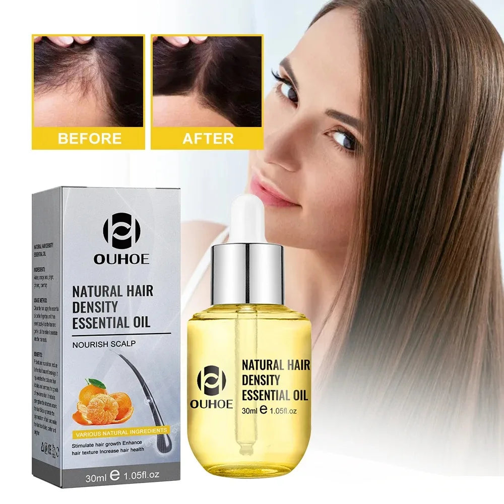 Natural Hair Growth Essential Oil Ginger Essence Hair Regrowth Thicken Hair Treatment Anti Hair Loss Gift Set For Men Women
